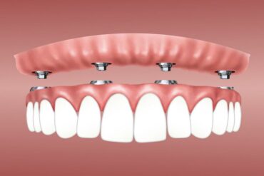 Защита зубной эмали и гигиена зубов